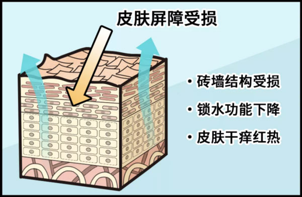 皮膚屏障受損后應該如何修護？